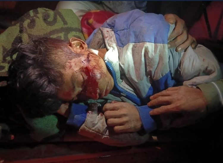 Youth injured by gun shot: 2 guns recover