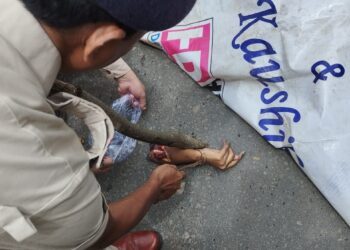 Woman Injured in Auto-Rickshaw Collision Near Old Raj Bhavan