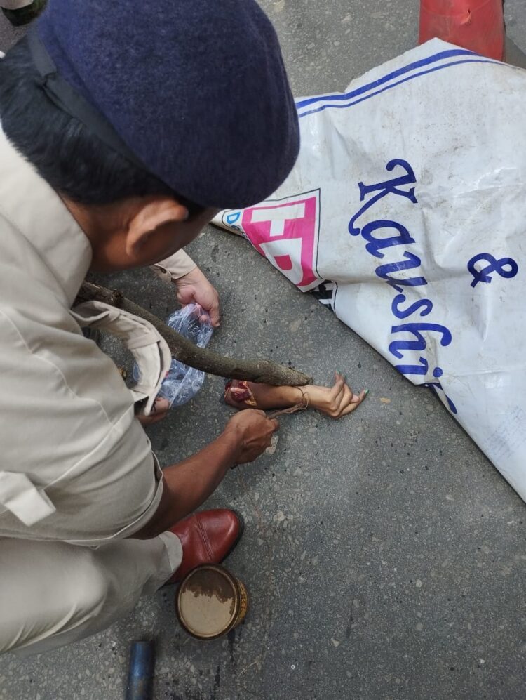 Woman Injured in Auto-Rickshaw Collision Near Old Raj Bhavan