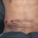 Youth seriously injured after being shot