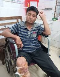 Gunfire in Khumulwng Leaves Two Injured; Police Launch Probe