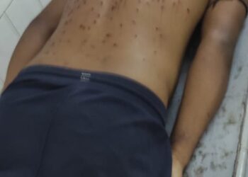 Youth Injured in BSF Firing at Boxnagar Border, Tensions Escalate in Surrounding Areas