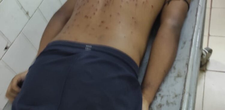 Youth Injured in BSF Firing at Boxnagar Border, Tensions Escalate in Surrounding Areas