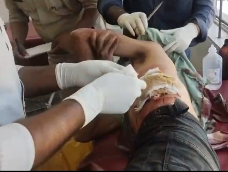 Youth Hurt in BSF Fire During Alleged Smuggling on Border