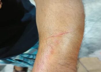 Churaibari Mosque Row Turns Violent, 1 Injured