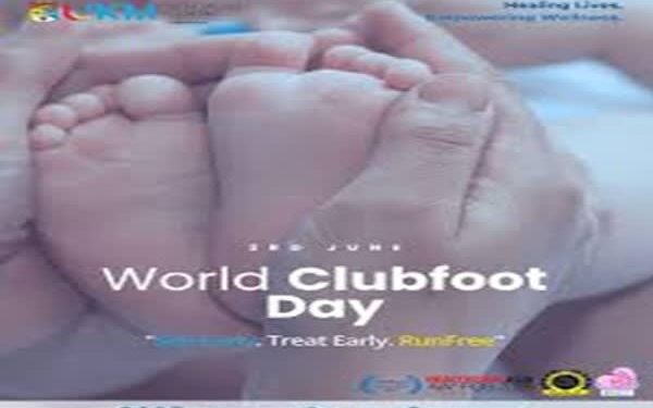World Clubfoot Day: Experts Highlight Benefits of Ponseti Method