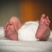 Tripura doctors save 18-day-old baby with rare intestinal condition